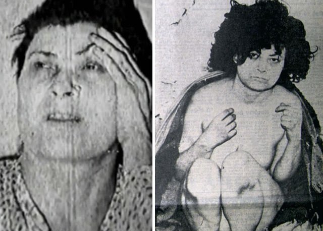 upothesi_kostaleeksi