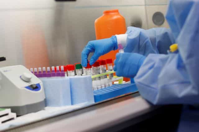 Λάρισα: Σε ύφεση τα κρούσματα Covid-19 παρά τη μεγάλη αύξηση των εισαγωγών πανελλαδικά